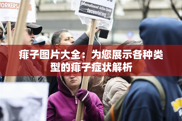 痱子图片大全：为您展示各种类型的痱子症状解析