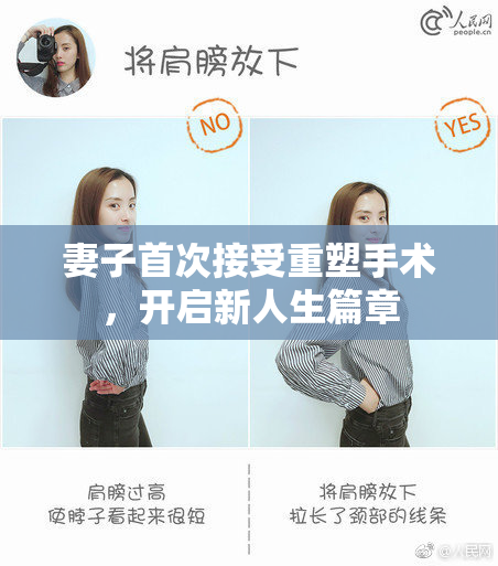 妻子首次接受重塑手术，开启新人生篇章
