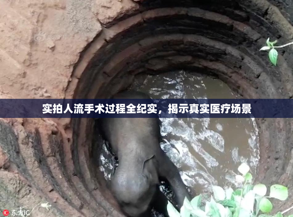 实拍人流手术过程全纪实，揭示真实医疗场景