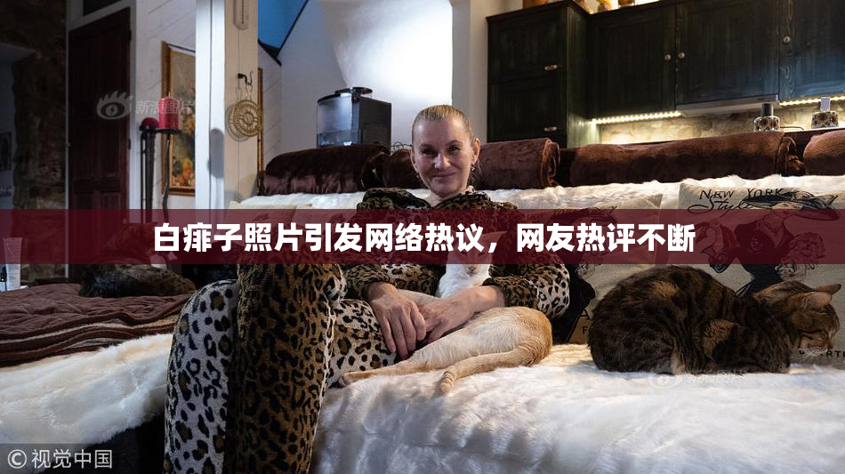 白痱子照片引发网络热议，网友热评不断