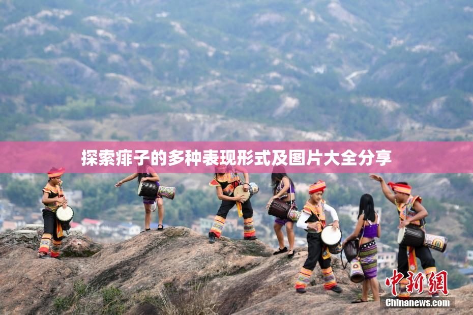 探索痱子的多种表现形式及图片大全分享