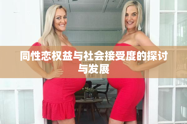 同性恋权益与社会接受度的探讨与发展