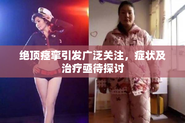 绝顶痉挛引发广泛关注，症状及治疗亟待探讨