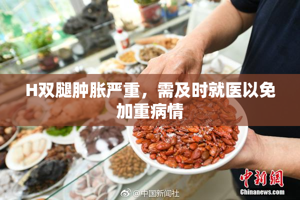 H双腿肿胀严重，需及时就医以免加重病情