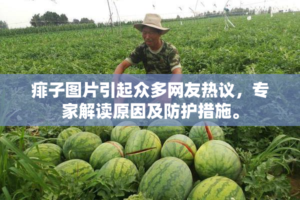 痱子图片引起众多网友热议，专家解读原因及防护措施。