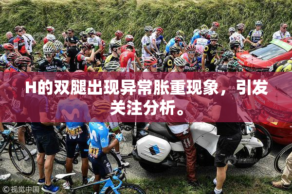 H的双腿出现异常胀重现象，引发关注分析。