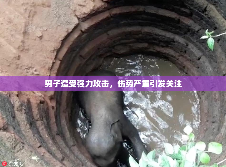男子遭受强力攻击，伤势严重引发关注