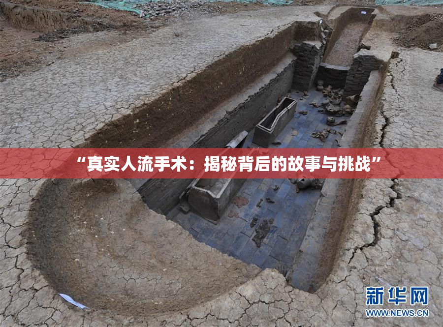 “真实人流手术：揭秘背后的故事与挑战”