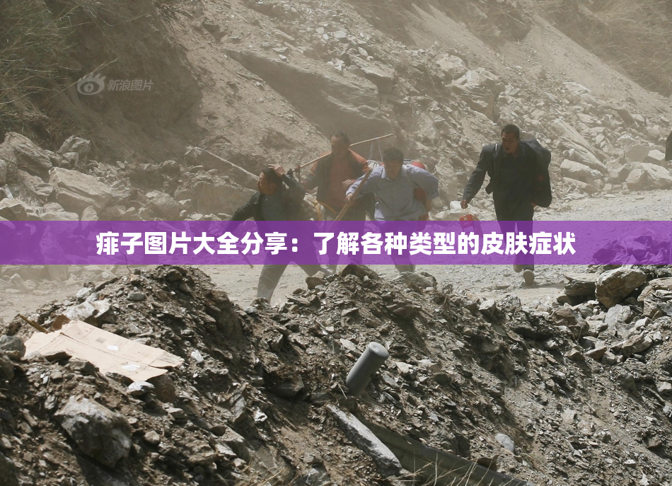 痱子图片大全分享：了解各种类型的皮肤症状